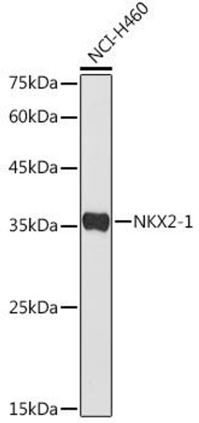 NKX2-1 Rabbit Polyclonal Antibody (CAB3097)
