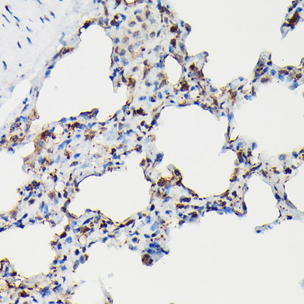 SFTPA1 Rabbit Polyclonal Antibody (CAB3133)
