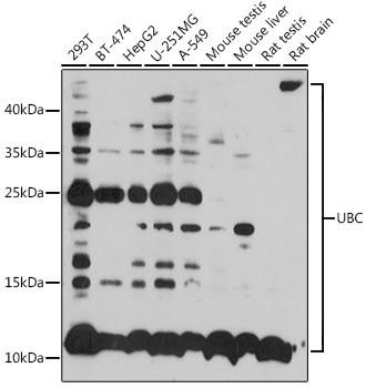 UBC Rabbit Polyclonal Antibody (CAB3207)