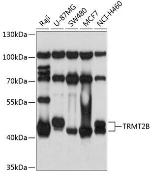TRMT2B Rabbit Polyclonal Antibody (CAB3509)