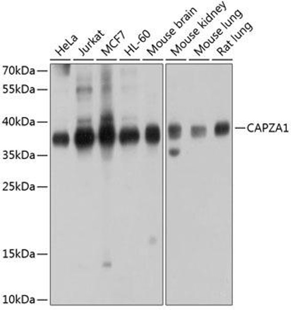 CAPZA1 Rabbit Polyclonal Antibody (CAB3776)