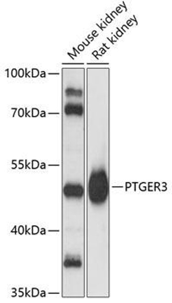 PGE receptor EP2 (PTGER3) Rabbit Polyclonal Antibody (CAB4057)