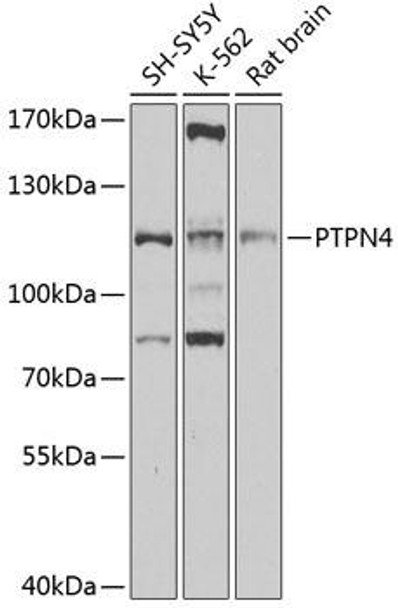 PTPN4 Rabbit Polyclonal Antibody (CAB4061)