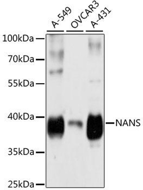 NANS Rabbit Polyclonal Antibody (CAB4778)