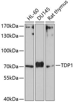 TDP1 Rabbit Polyclonal Antibody (CAB4849)