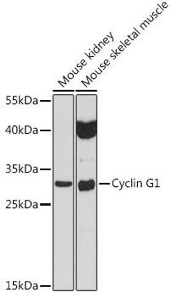 Cyclin G1 Rabbit Polyclonal Antibody (CAB5292)