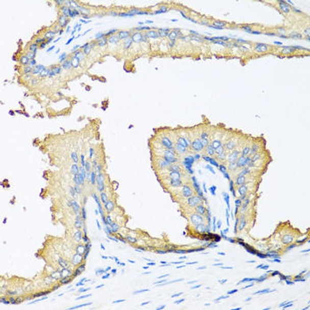 NOV Rabbit Polyclonal Antibody (CAB5320)