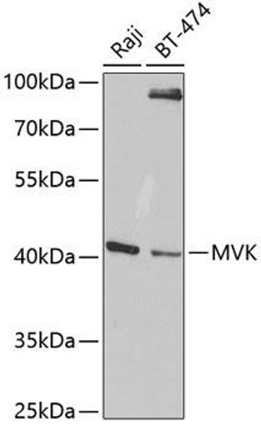 MVK Rabbit Polyclonal Antibody (CAB5354)