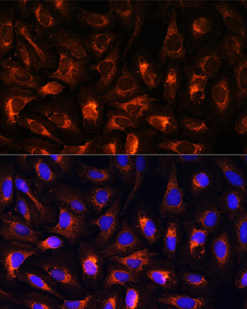 CART Rabbit Polyclonal Antibody (CAB5395)