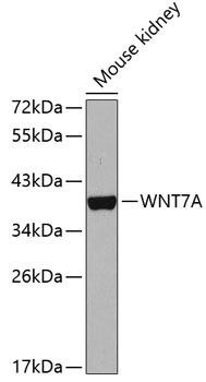WNT7A Rabbit Polyclonal Antibody (CAB5425)