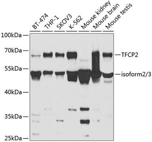 TFCP2 Rabbit Polyclonal Antibody (CAB5555)
