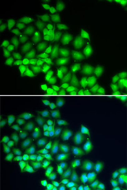 XPD/ERCC2 Rabbit Polyclonal Antibody (CAB5640)