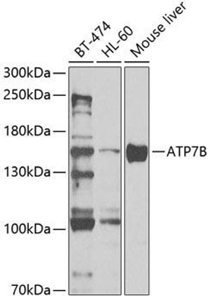 ATP7B Rabbit Polyclonal Antibody (CAB5676)