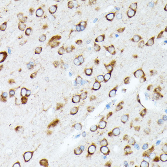 RPL7 Rabbit Polyclonal Antibody (CAB5932)