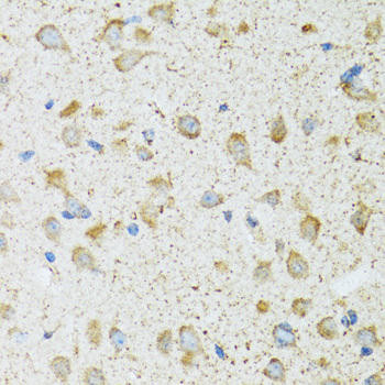 COG2 Rabbit Polyclonal Antibody (CAB6251)