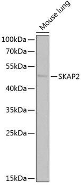 SKAP2 Rabbit Polyclonal Antibody (CAB6435)