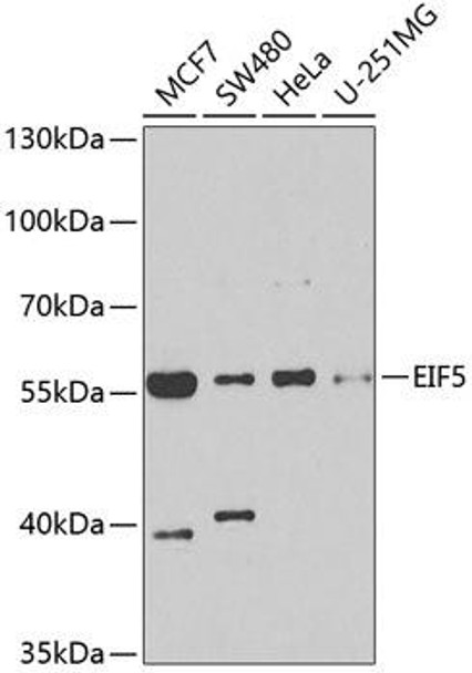 EIF5 Rabbit Polyclonal Antibody (CAB6583)