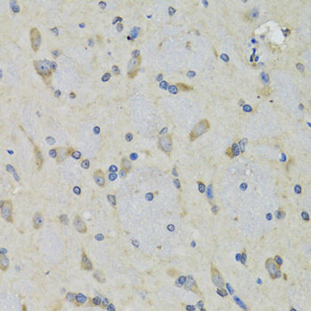RAE1 Rabbit Polyclonal Antibody (CAB6713)