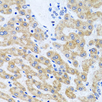 SCO1 Rabbit Polyclonal Antibody (CAB6734)