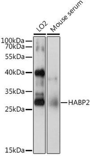 HABP2 Rabbit Polyclonal Antibody (CAB6919)