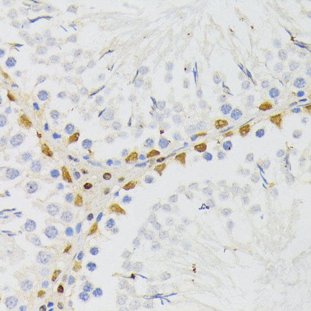 ELAC2 Rabbit Polyclonal Antibody (CAB7128)