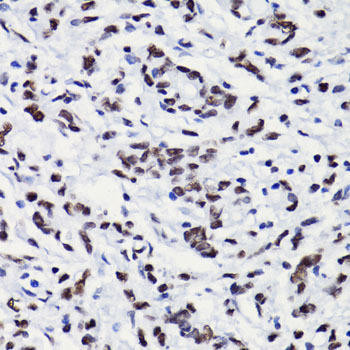 Epigenetics and Nuclear Signaling Antibodies 4 Anti-Acetyl-Histone H3-K18 Antibody CAB7257