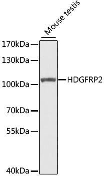HDGFRP2 Rabbit Polyclonal Antibody (CAB7484)