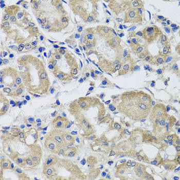 ST8SIA2 Rabbit Polyclonal Antibody (CAB7748)