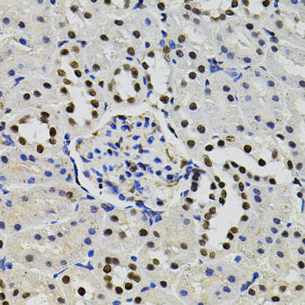 GTF2I Rabbit Polyclonal Antibody (CAB7898)