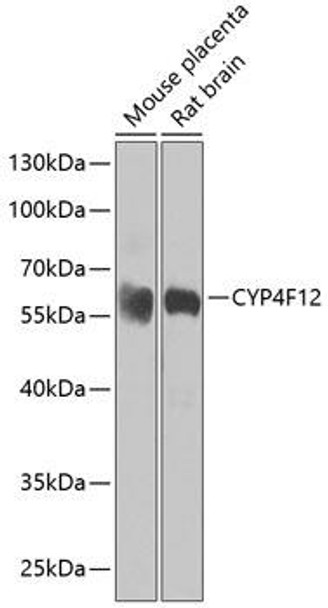 CYP4F12 Rabbit Polyclonal Antibody (CAB7993)