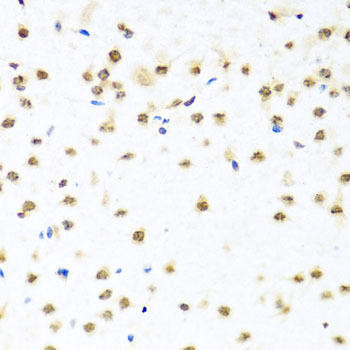 RAB3IP Rabbit Polyclonal Antibody (CAB8094)