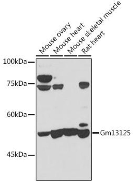 Gm13125 Rabbit Polyclonal Antibody (CAB8095)