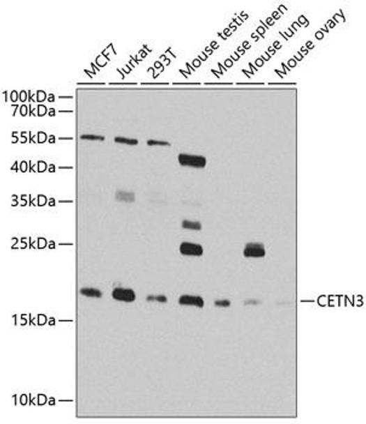 CETN3 Rabbit Polyclonal Antibody (CAB8111)