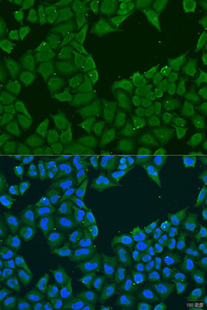 MAGEA6 Rabbit Polyclonal Antibody (CAB8130)
