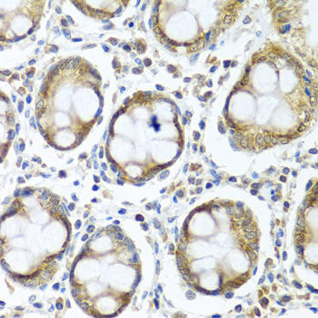 Cell Biology Antibodies 12 Anti-IFI44 Antibody CAB8188