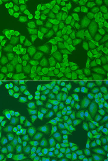 Cell Biology Antibodies 12 Anti-IFI44 Antibody CAB8188