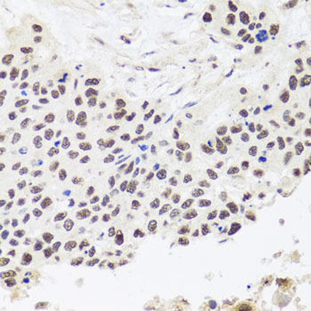 RPP30 Rabbit Polyclonal Antibody (CAB8479)