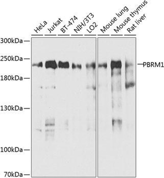 PBRM1 Rabbit Polyclonal Antibody (CAB9878)