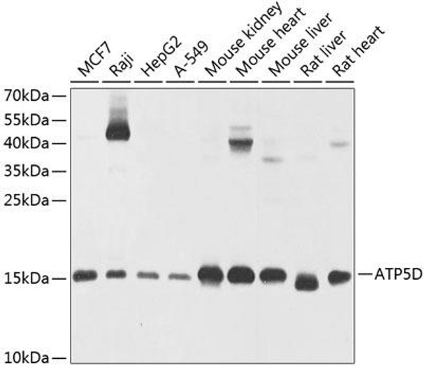 ATP5D Rabbit Polyclonal Antibody (CAB9929)