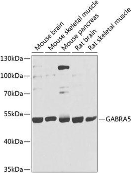 GABRA5 Rabbit Polyclonal Antibody (CAB9932)