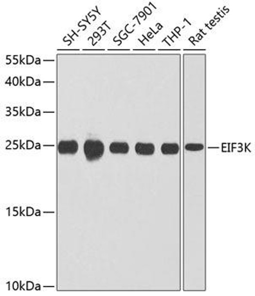 EIF3K Rabbit Polyclonal Antibody (CAB9969)