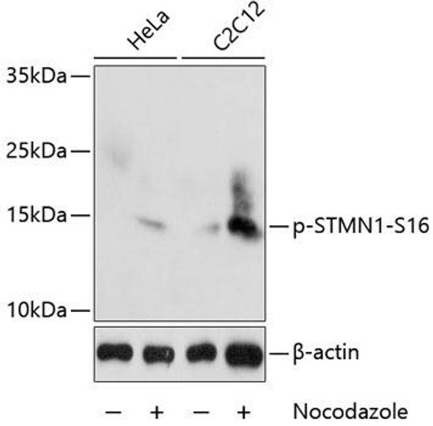Phospho-Stathmin 1-S16 Rabbit Polyclonal Antibody (CABP0229)