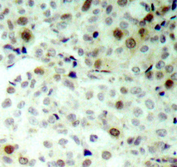 Phospho-CDK2-T160 Rabbit Polyclonal Antibody (CABP0325)