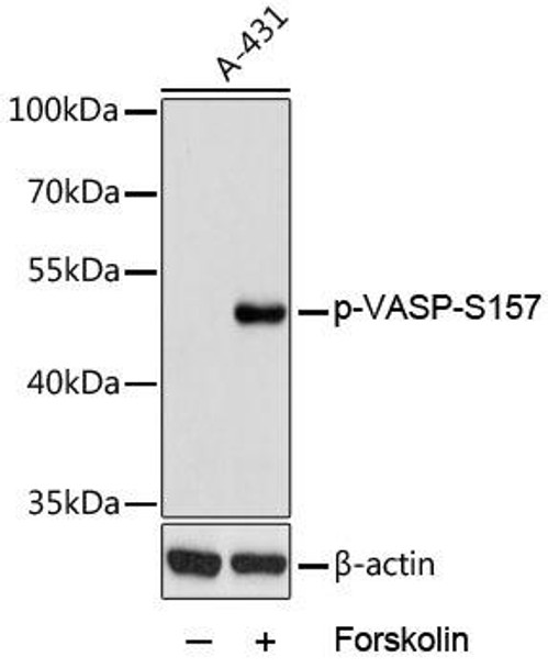 Phospho-VASP-S157 Rabbit Polyclonal Antibody (CABP0763)