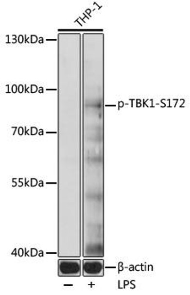 Anti-Phospho-TBK1-S172 pAb Antibody (CABP0847)