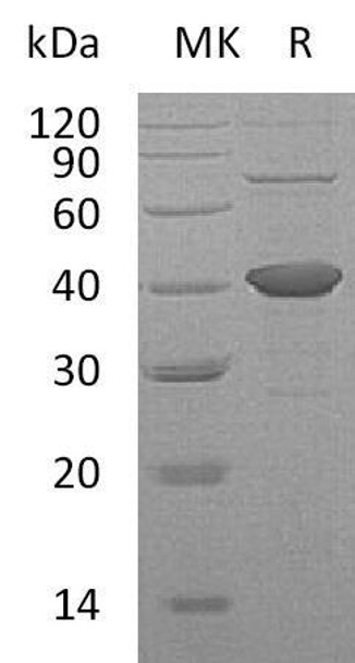 Human SORD Recombinant Protein (RPES0120)