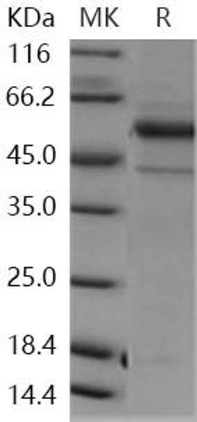 Human NTPDase 2/ENTPD2 Recombinant Protein (RPES0213)