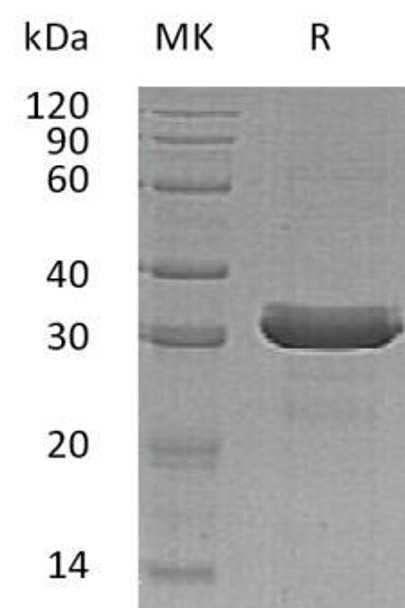 Human HDGFRP3/HDGFL3 Recombinant Protein (RPES0278)