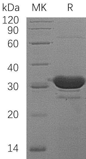 Human HDHD2 Recombinant Protein (RPES0297)
