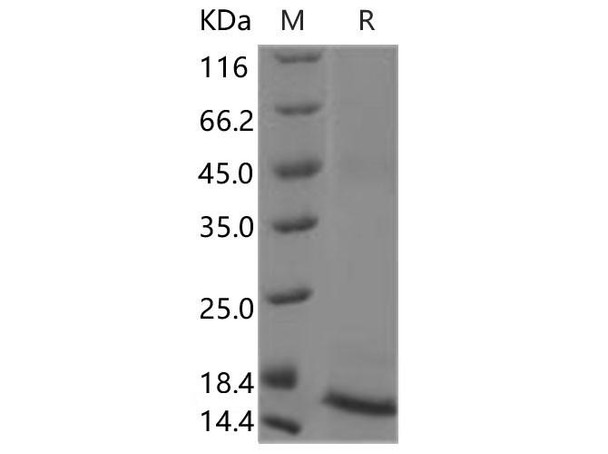 Rat TGFB1/TGF-beta 1 Recombinant Protein  (RPES0300)